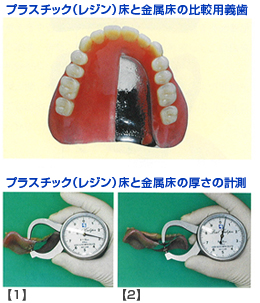 総義歯の「床部分」の種類